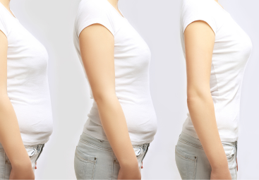 Tendencias en cirugía plástica 2026: impacto de los fármacos para adelgazar