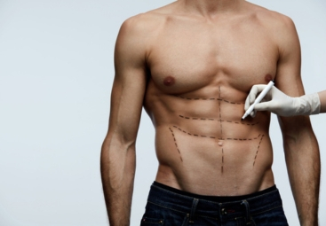 Cirugía Plástica Masculina: Rompiendo Estereotipos.