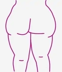 Lipoelastic.es - lipoedema-001-1553013033-5f68a07a30b5f.jpg.webp